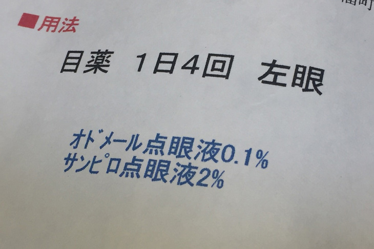 眼科で目薬を処方されたが、「瞳孔の調節機能の軽いマヒ」は完治するのだろうか……。