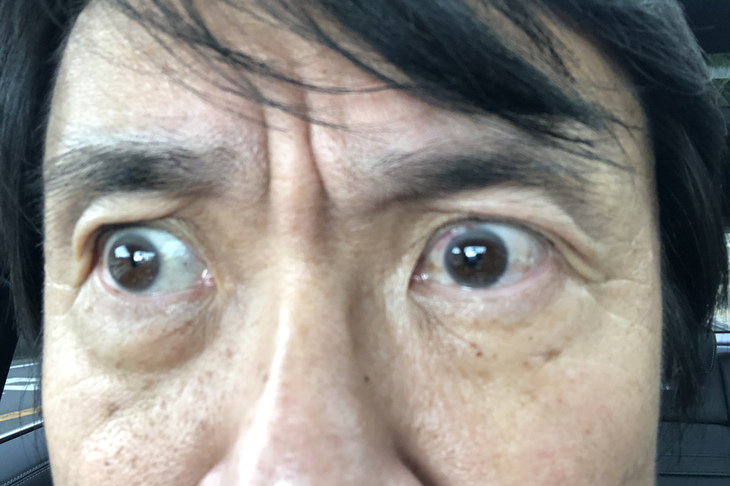 左目だけよく見えるようになったので、左右の画像がすぐに一致しないという違和感も残っているが、あんなこわい手術をもう一度受ける気にはなれない。左側は最新のLEDヘッドランプ、右側はハロゲンランプのままで走っていくことにする。